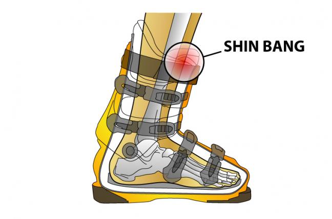 Ski Boot Fitting Guide | Shin Bang Explained